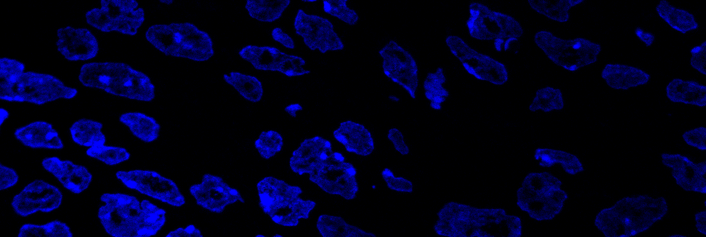 Appreciating the complexity of DNA folding
