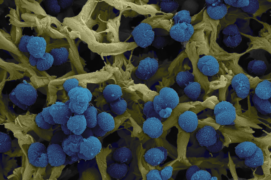 The scavenger inside your nose