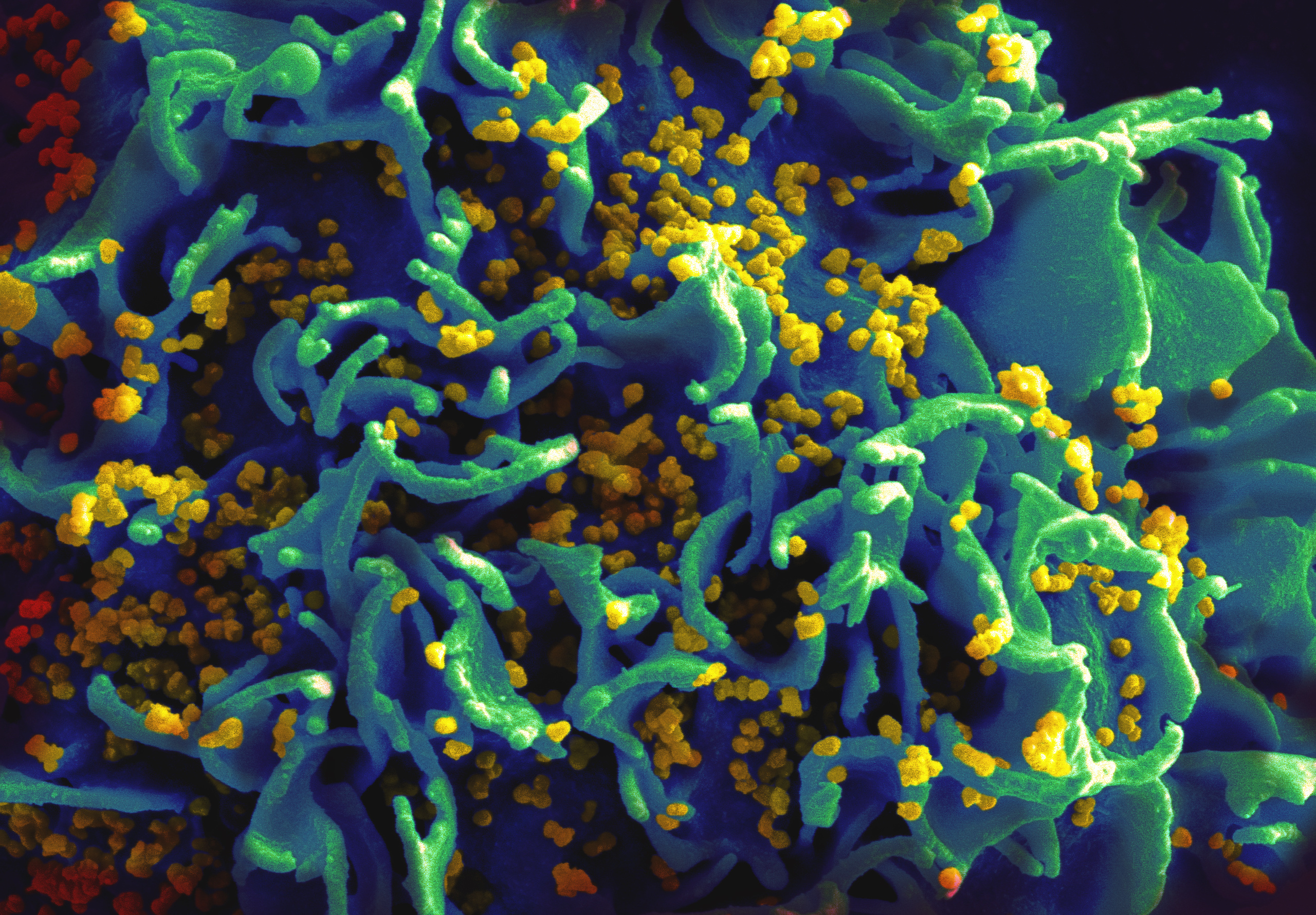 Looking back at 35 years of HIV research