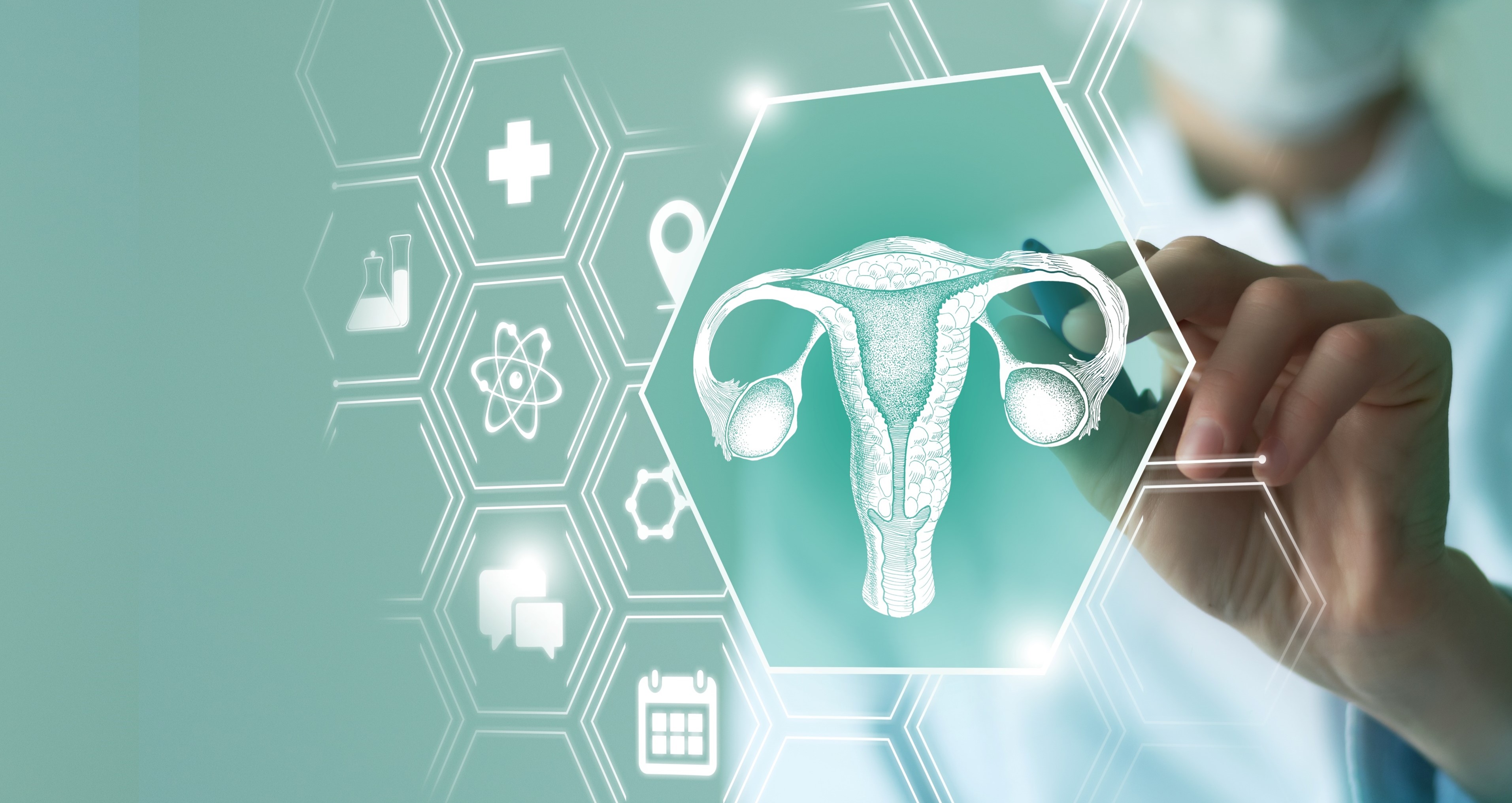 Minimally invasive testing using molecular approaches for endometrial cancer diagnosis: the game-changer in cost-effective detection among women with postmenopausal bleeding