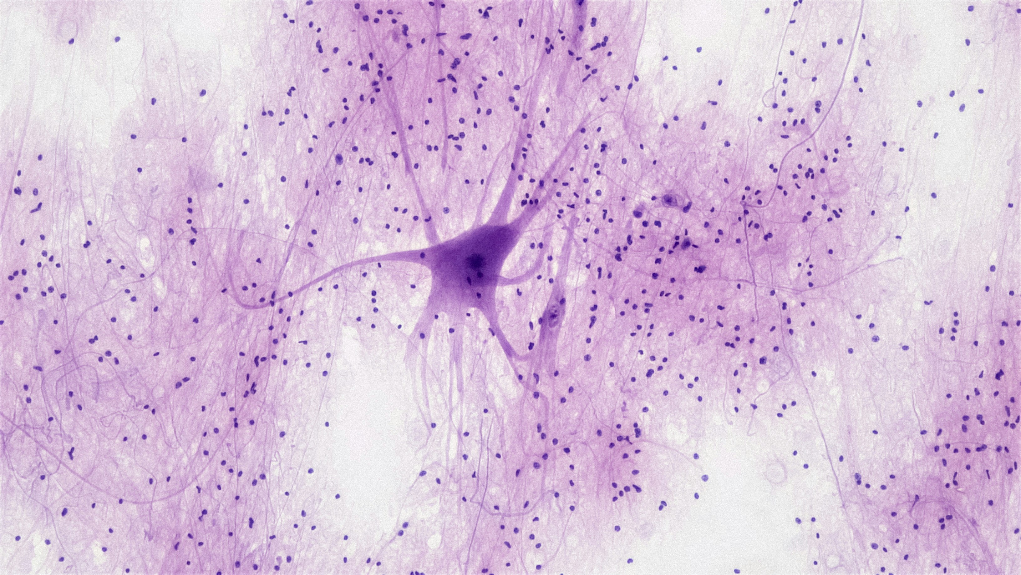 The Generational Infection of Toxoplasmosis 