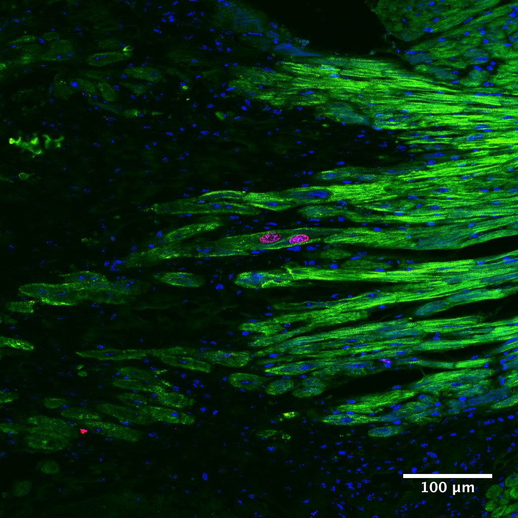 Engineering a hydrogel to regenerate muscle after heart attack 