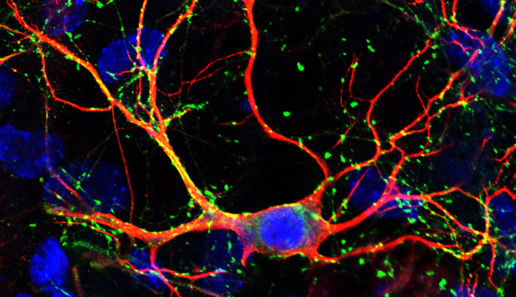 MYT1L haploinsufficiency in human neurons and mice causes autism-associated phenotypes that can be reversed by genetic and pharmacologic intervention