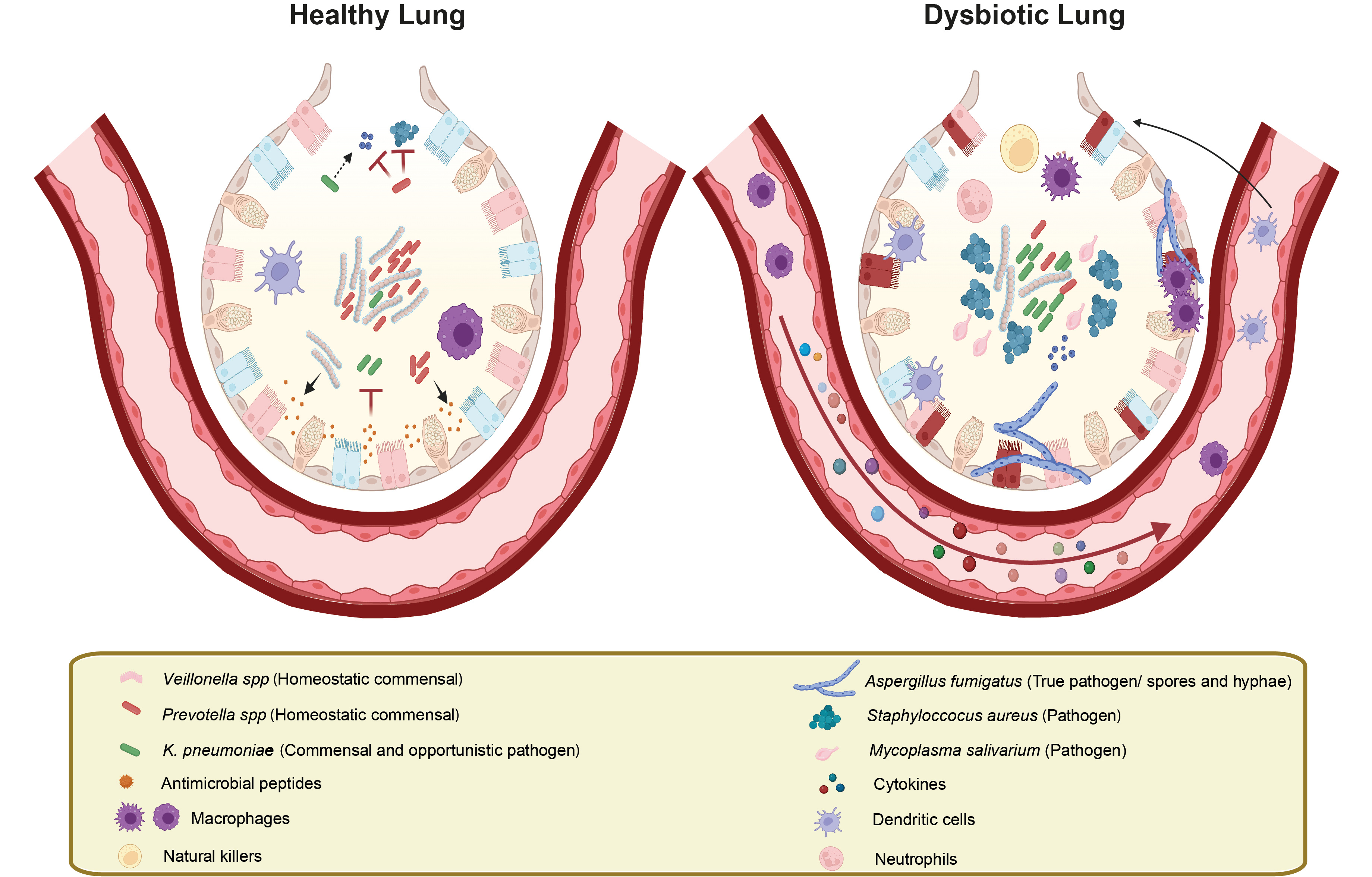 Polymicrobial Infections – A Life-Long Tug of War between Immunity and Pathogens
