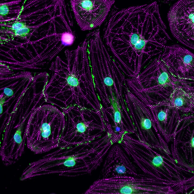 Human stem cells to model congenital heart disease