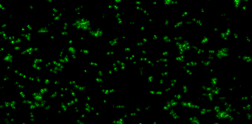 Cracking the Archaeal Cell Wall: How a hydrolase overturned a 50-year-old paradigm