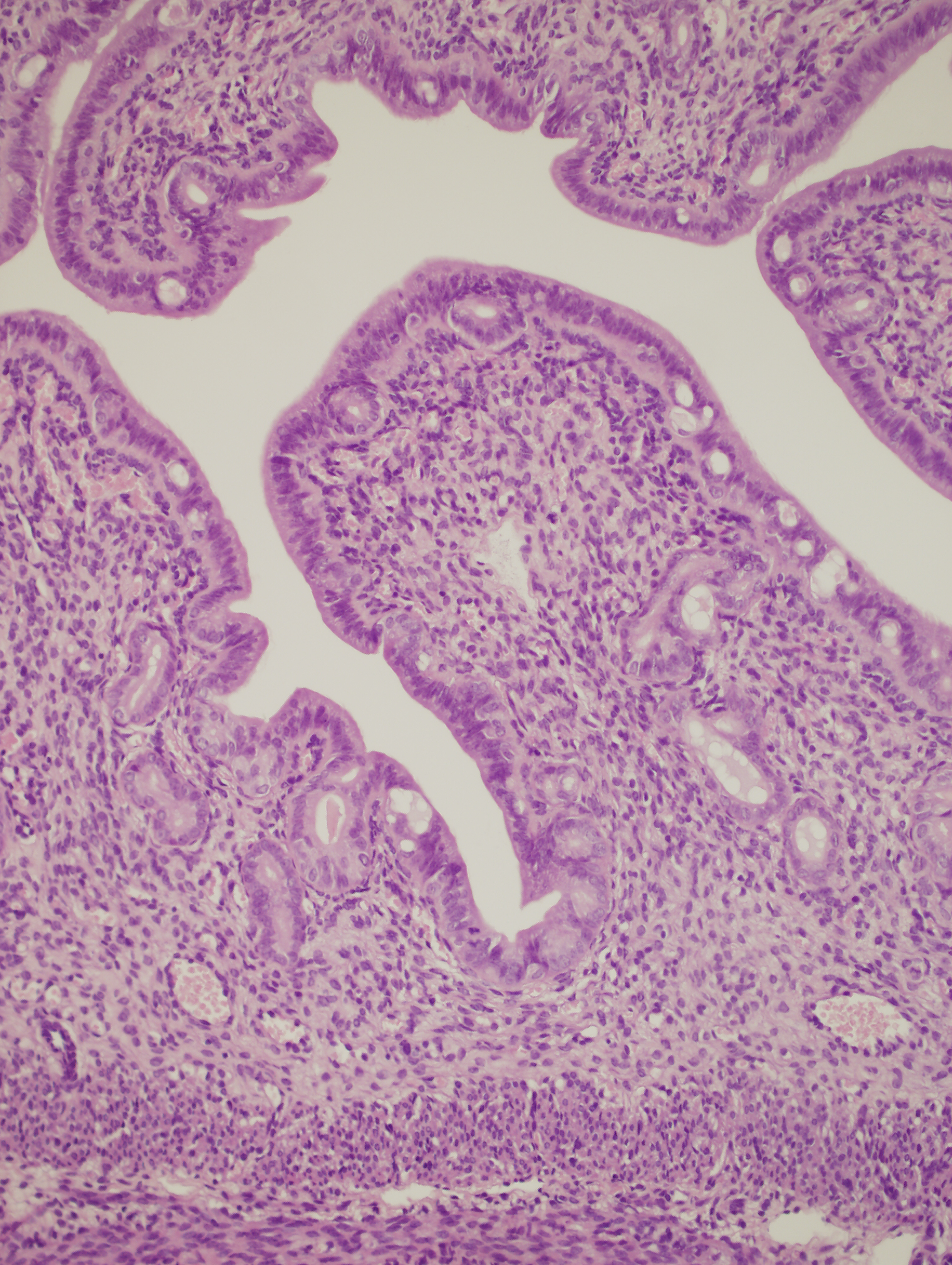 Fasting-mimicking diet and hormone therapy induce breast cancer regression