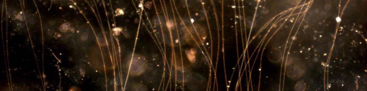 Dancers in the Mud: Cable Break Spoils Microbial Party