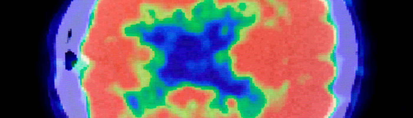 Radioisotopes and radiochemistry in health science 