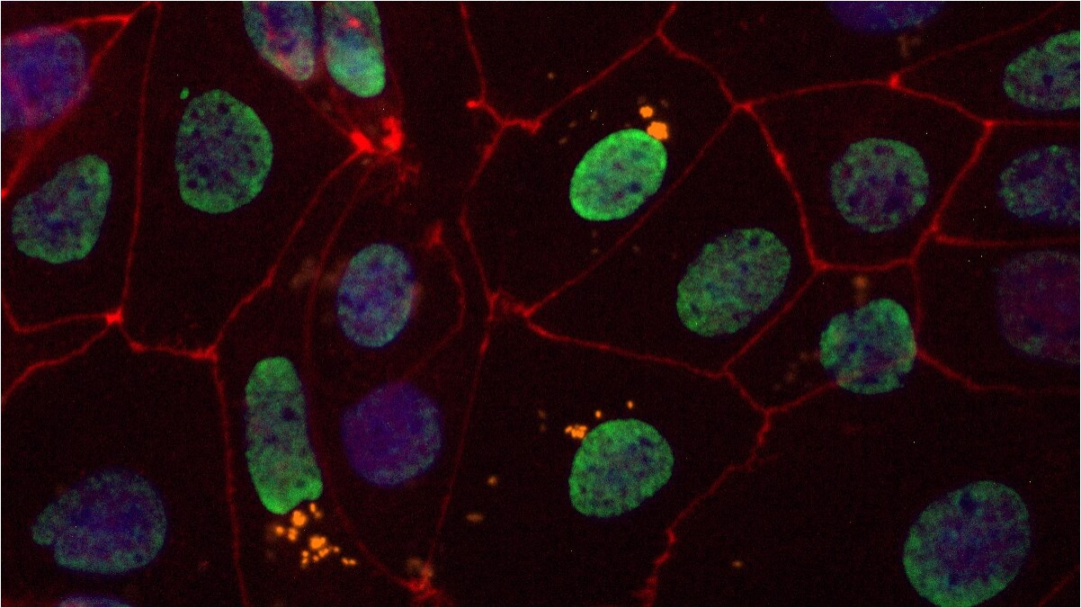 One Question, Millions of Cells: How MALVINA Was Born