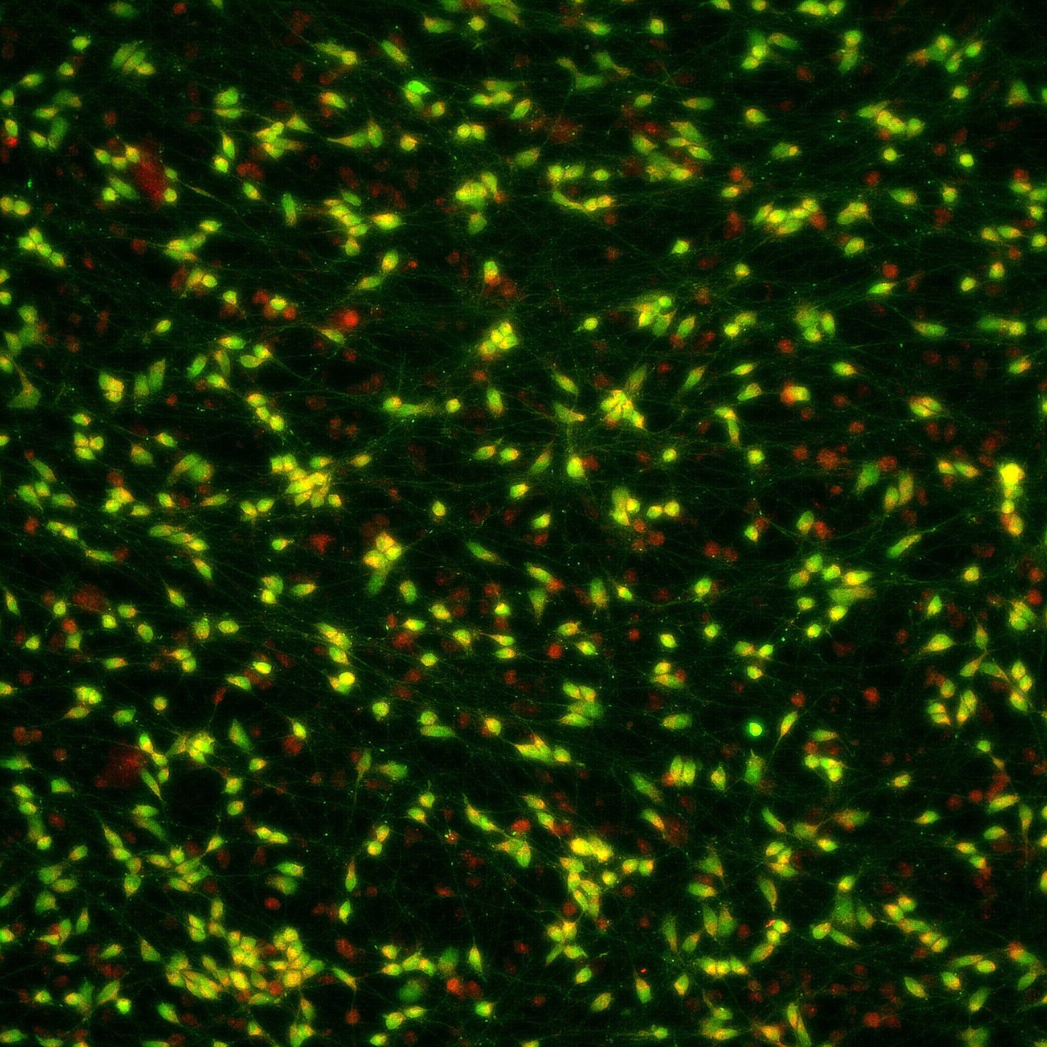 Behind the Paper: Exploring the neuroprotective potential of Nrf2-pathway activators against annonacin toxicity