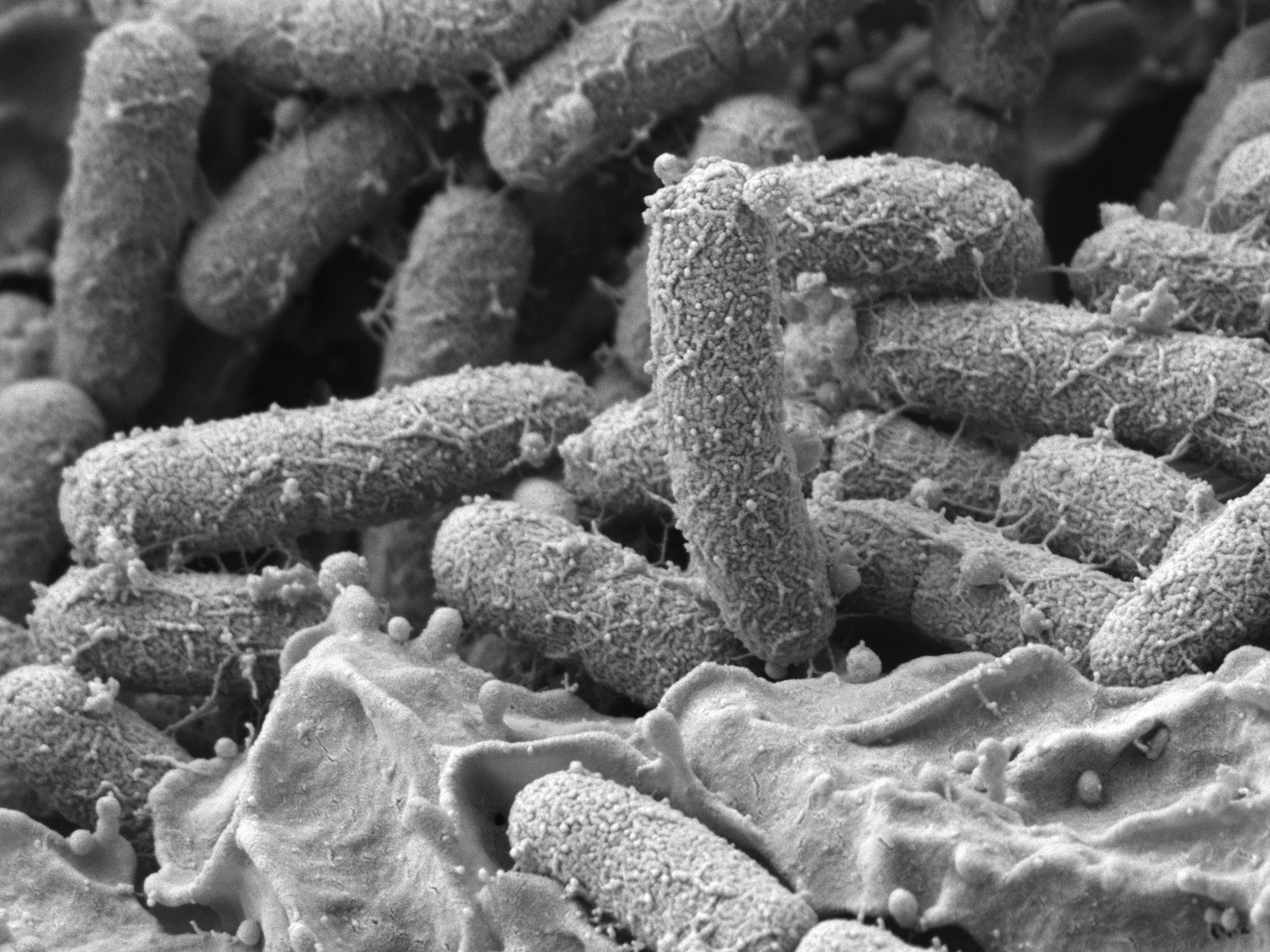 Modeling — and "remodeling" — in urinary tract infection research