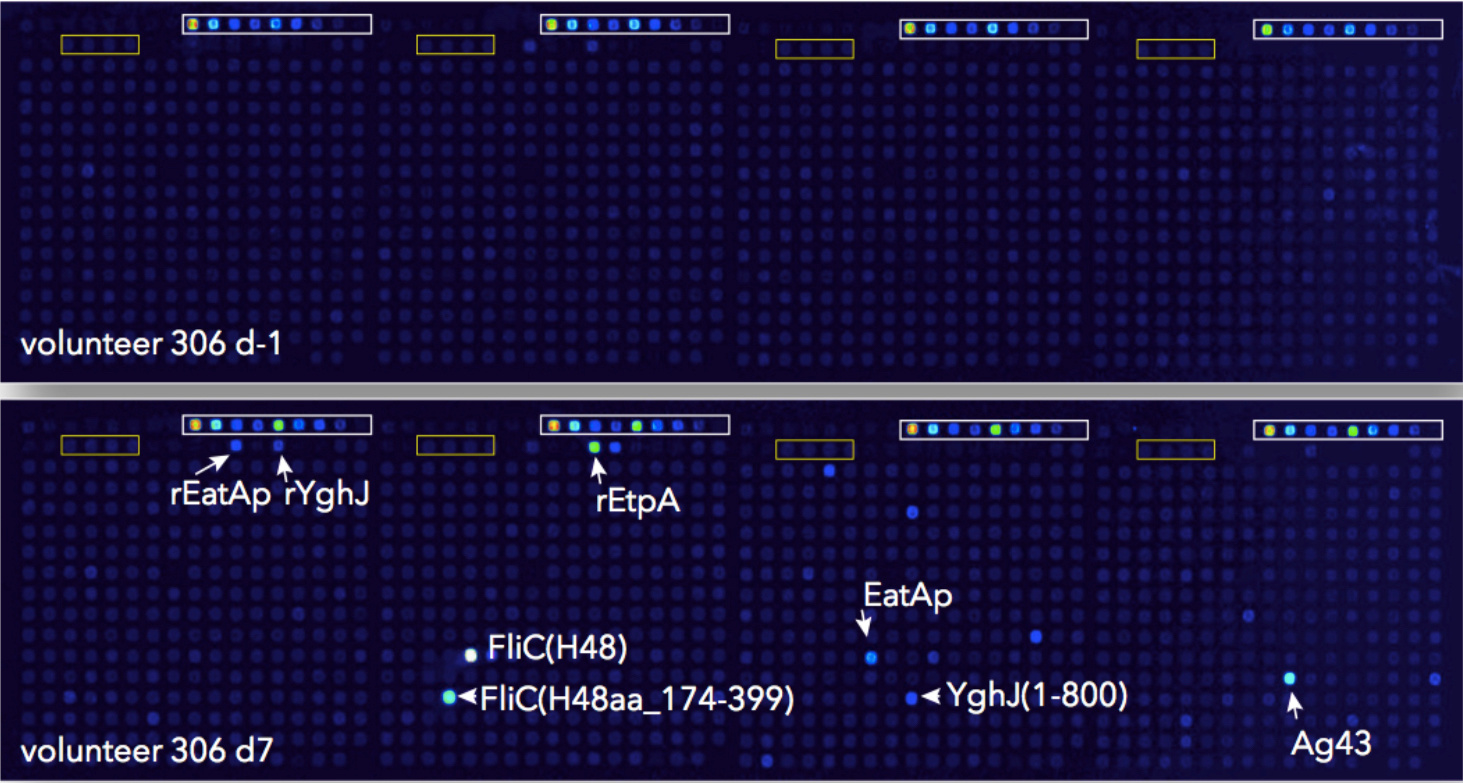 What are we missing?  Comparing the immunoproteomes of enterotoxigenic E. coli infected and vaccinated hosts can yield insights for rational vaccine design. 