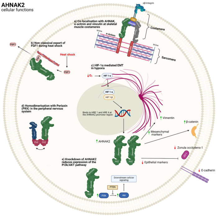 AHNAK2, a clue that may lead us to diagnosing Pancreatic Cancer earlier 