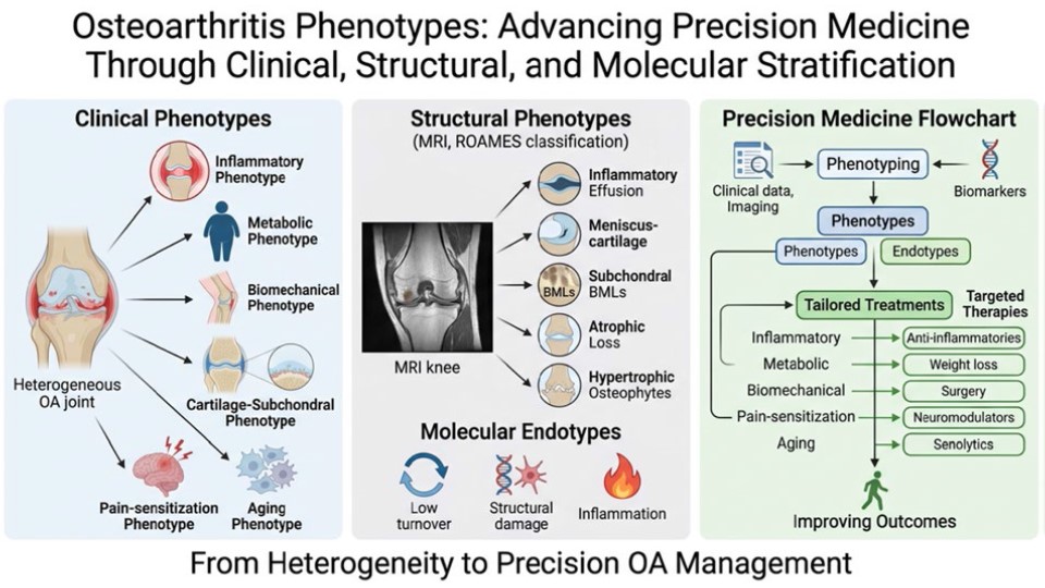 Beyond “Wear and Tear”: The Story Behind Our Paper on Osteoarthritis Phenotypes