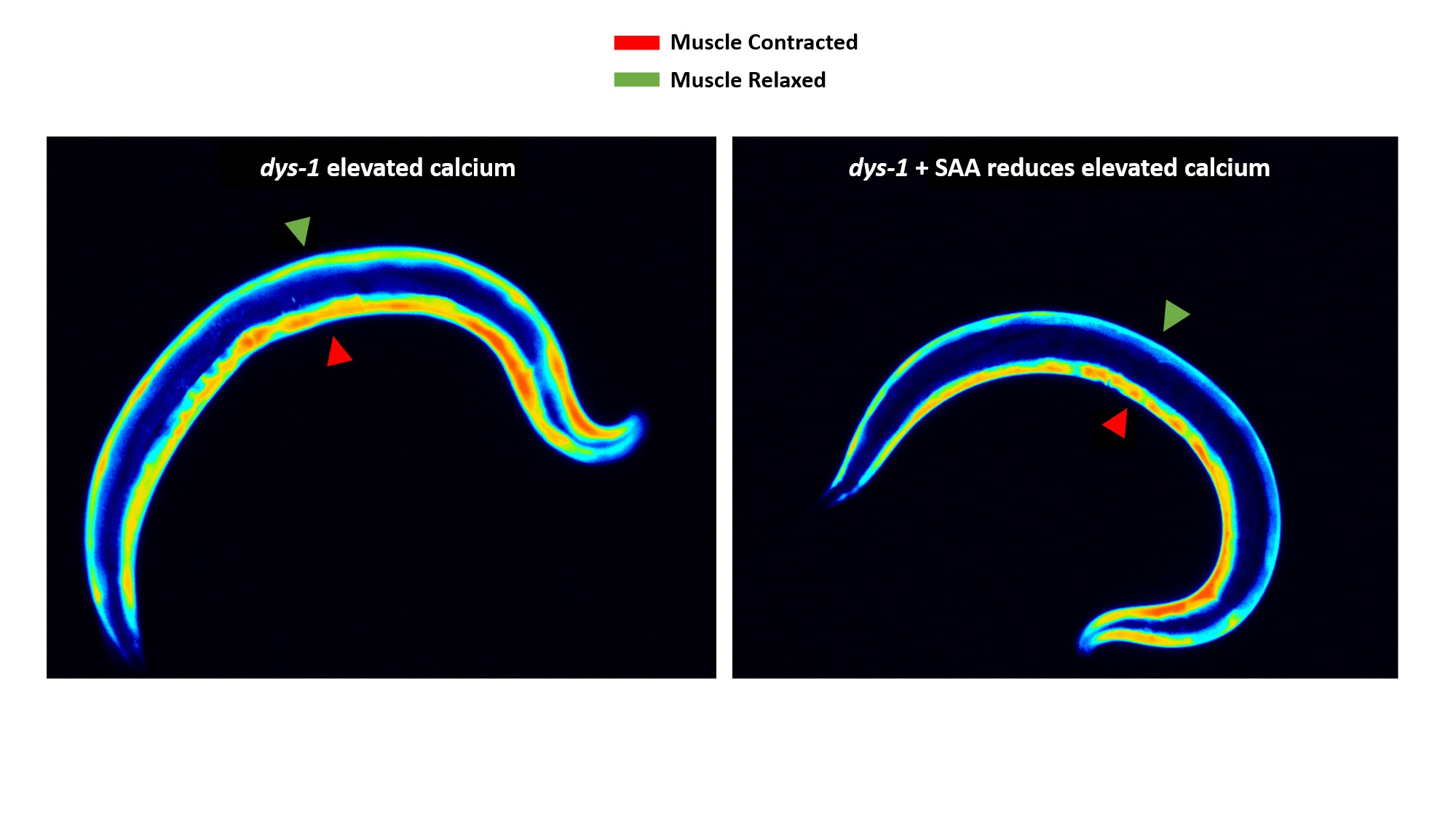 Sulfur Amino Acid supplementation may hold promise in Muscular dystrophy