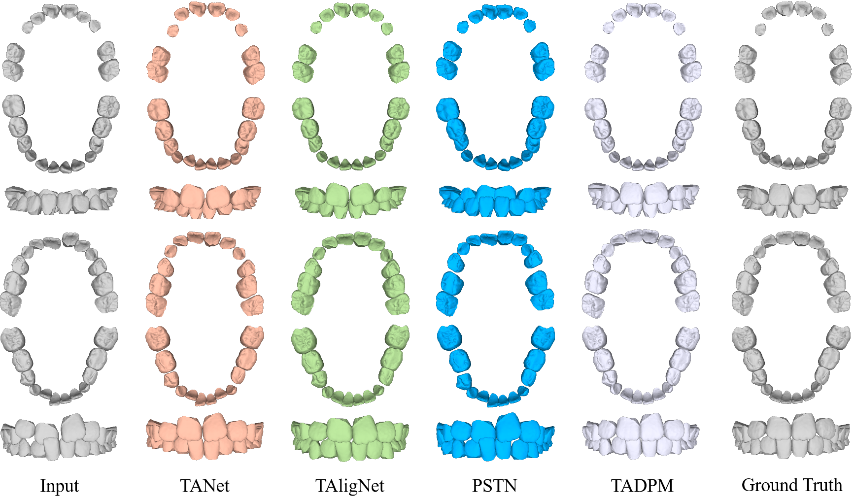 A 3D dental model dataset with pre/post-orthodontic treatment for